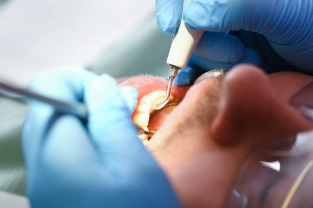 Best Broken or Chipped Tooth Repair in Pleasant View, TN